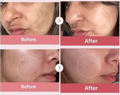 بوستر سرم کلاژن مدیکیوب Medicube collagen glow booster - Image 2