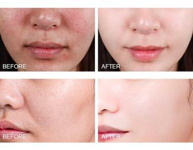 تونر اسنس هلو نیاسینامید آنوا Anua Peach 77 Niacin Essence Toner - Image 2